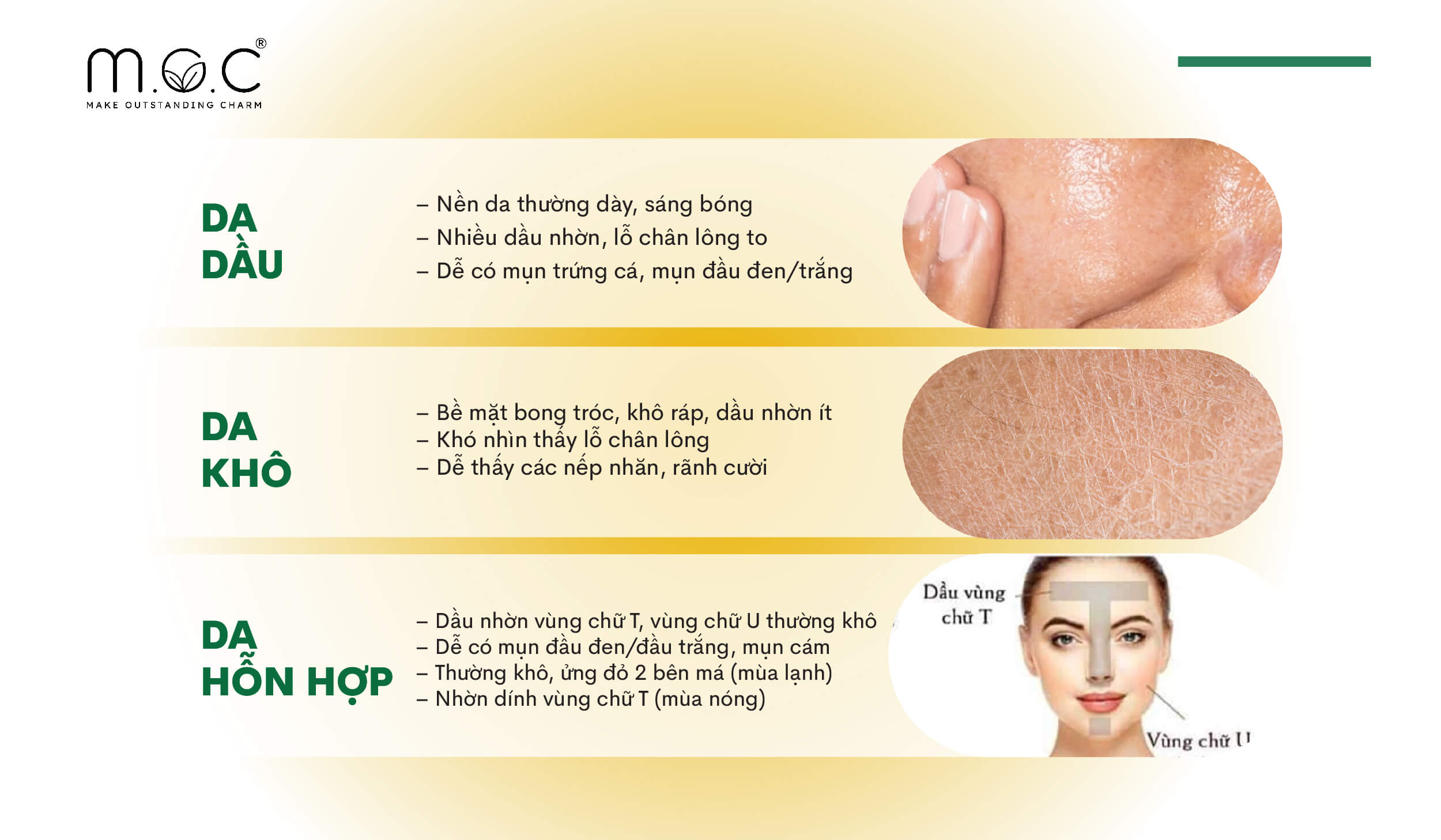 Da của bạn thuộc nhóm Da dầu, da khô hay da hỗn hợp?