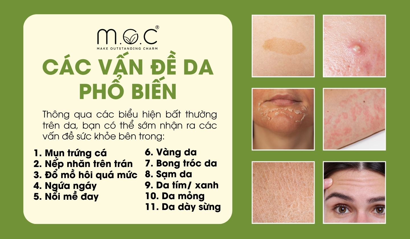 Các vấn đề da phổ biến