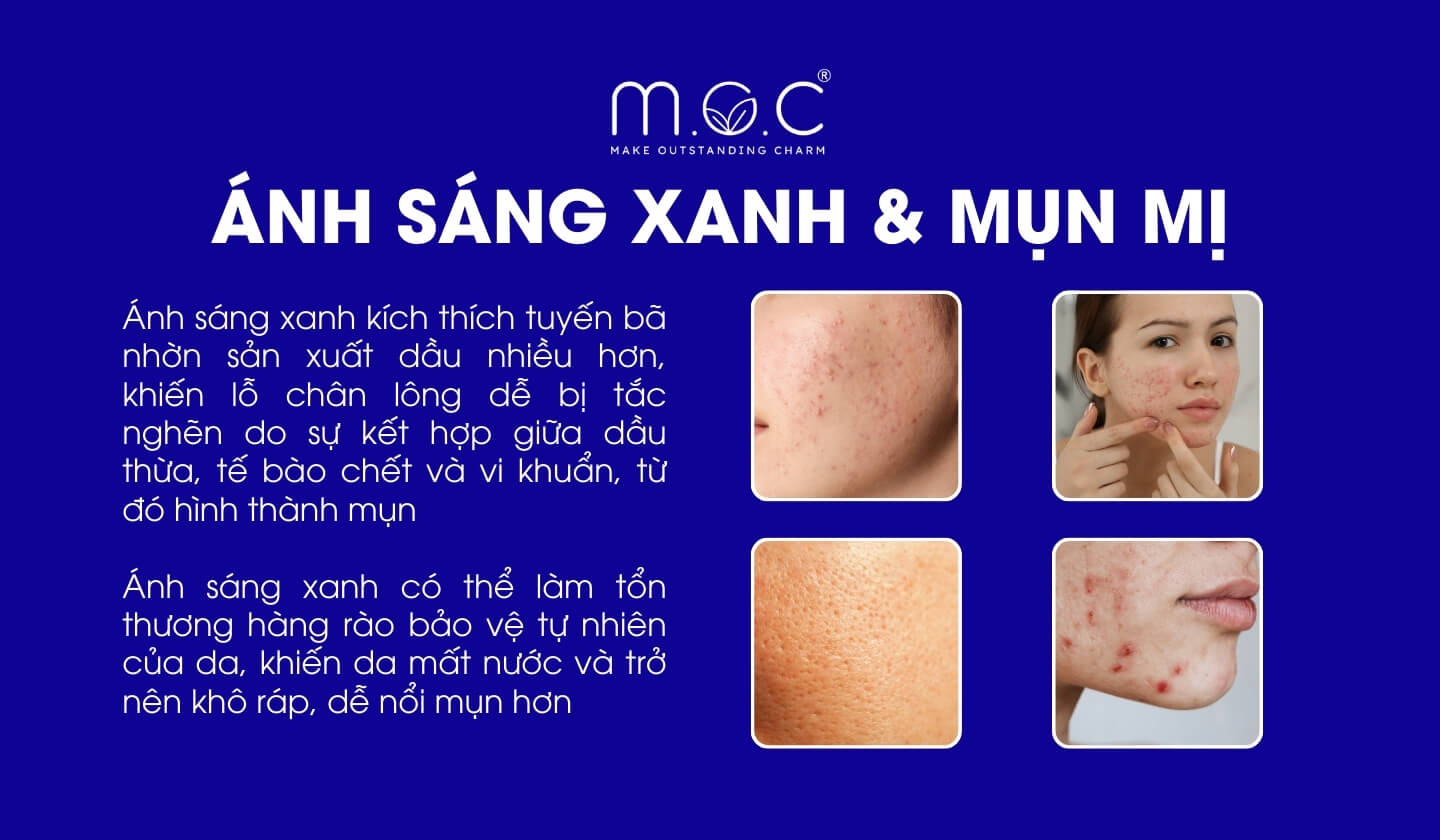 Ánh sáng xanh khiến da dễ nổi mụn