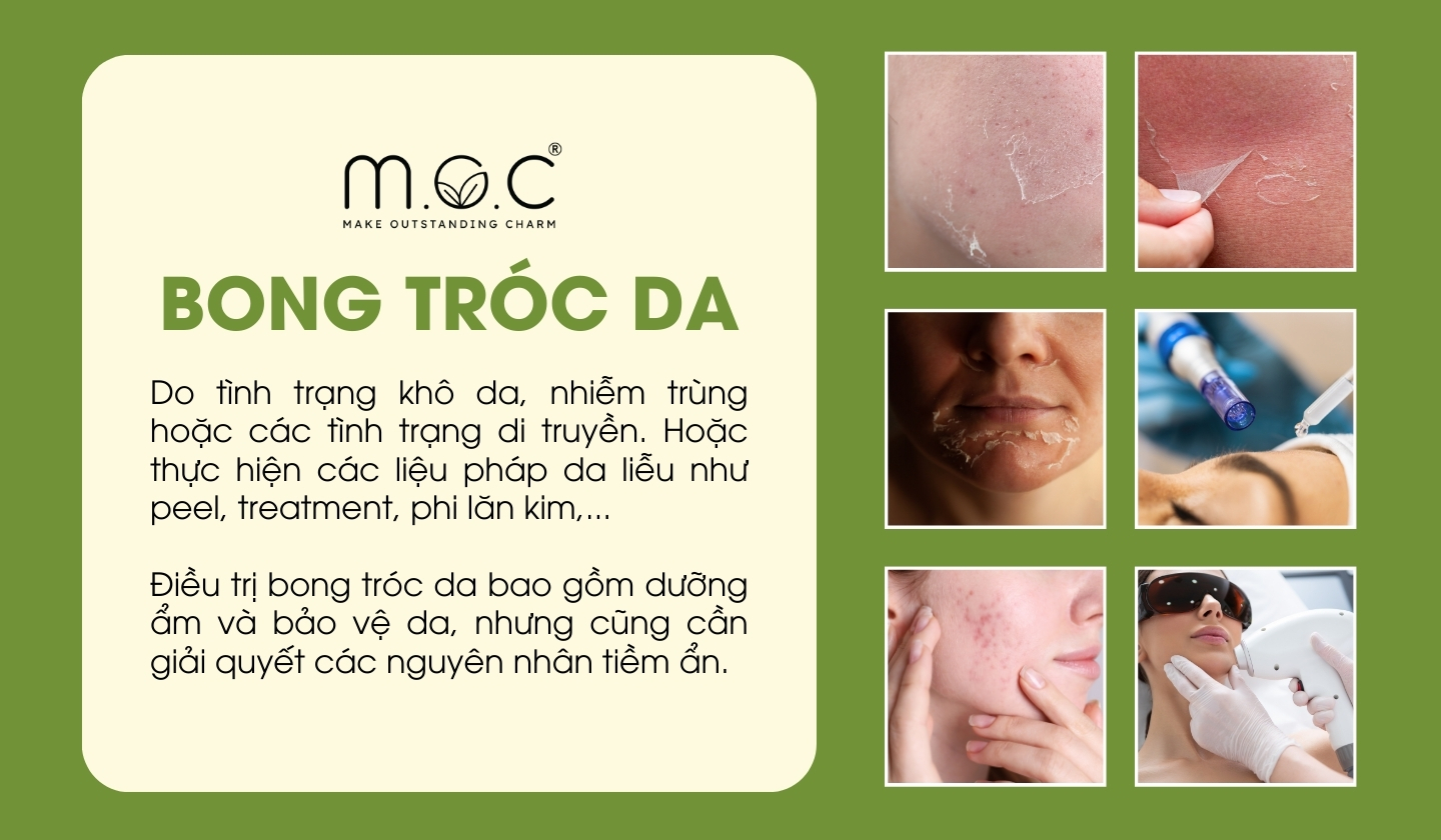 Bong tróc da phản ánh tình trạng sức khỏe ra sao?