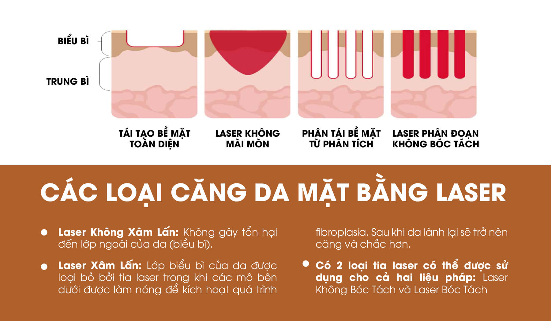 Các loại laser căng da mặt