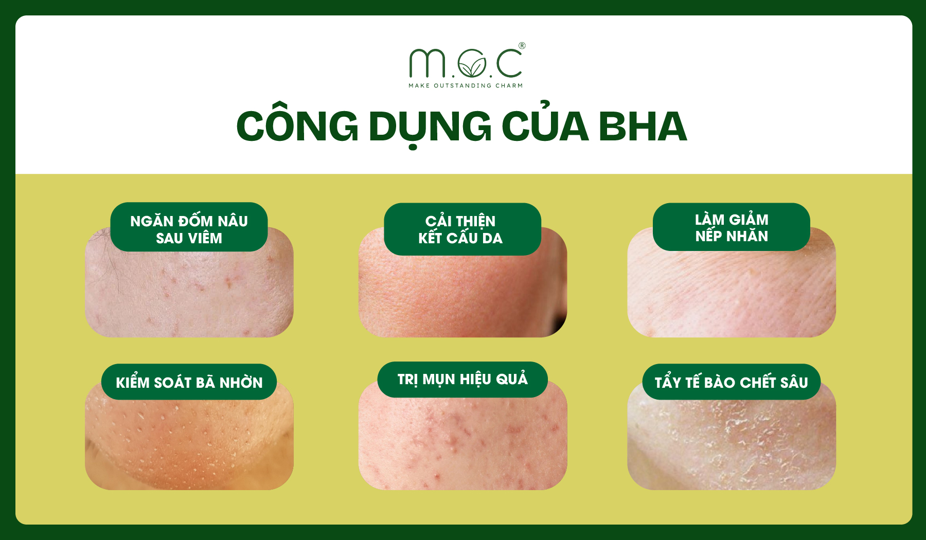 Các công dụng nổi bật của Acid Salicylic