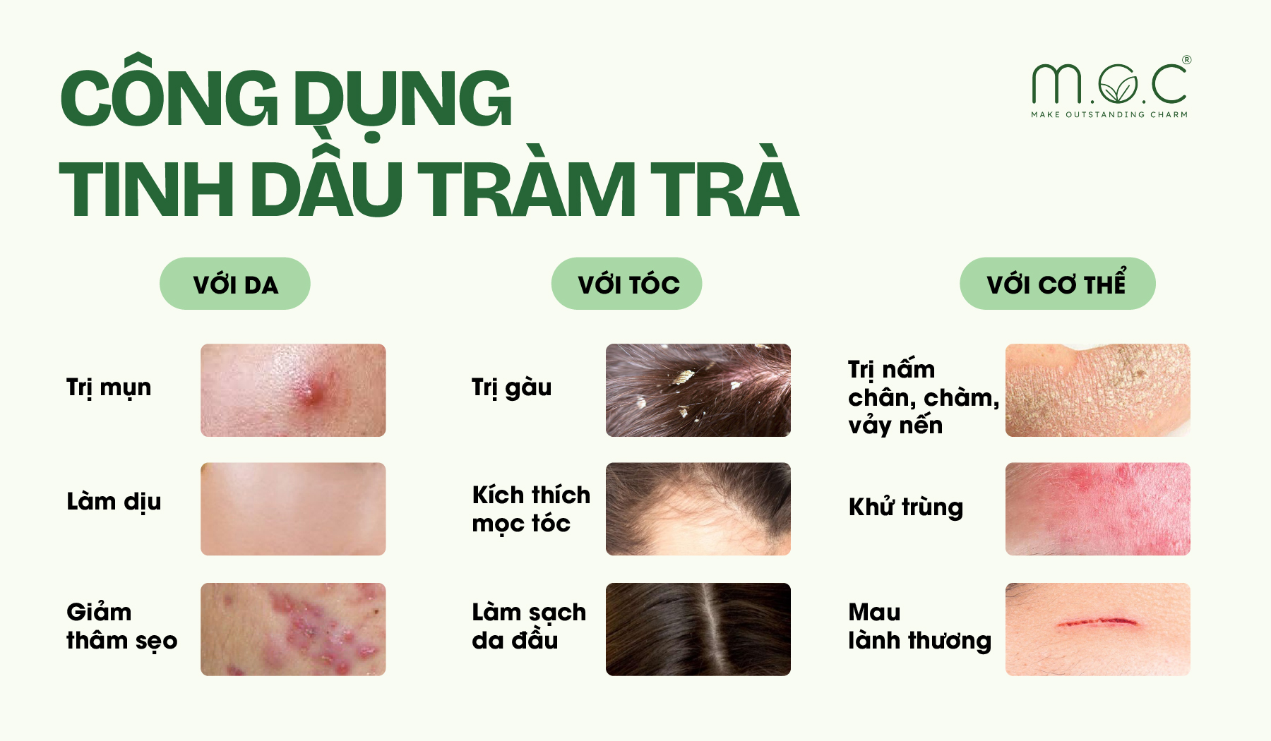 Các công dụng của tinh dầu tràm trà