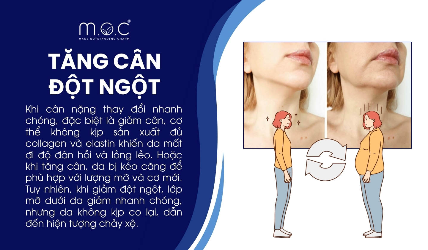 Da chảy xệ do tăng cân hoặc giảm cân đột ngột