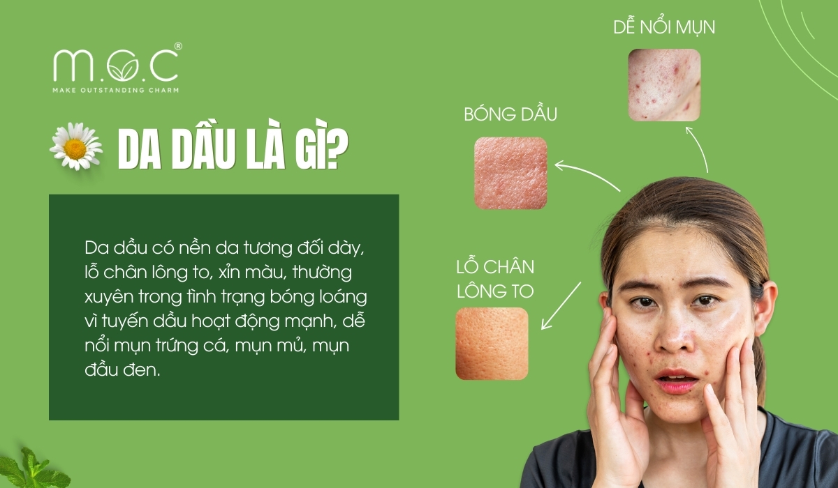 Nhận biết Da dầu mụn nhạy cảm