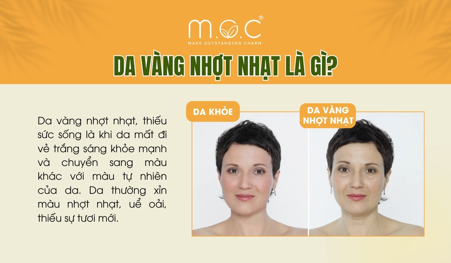 Da nhợt nhạt, xanh xao là gì?