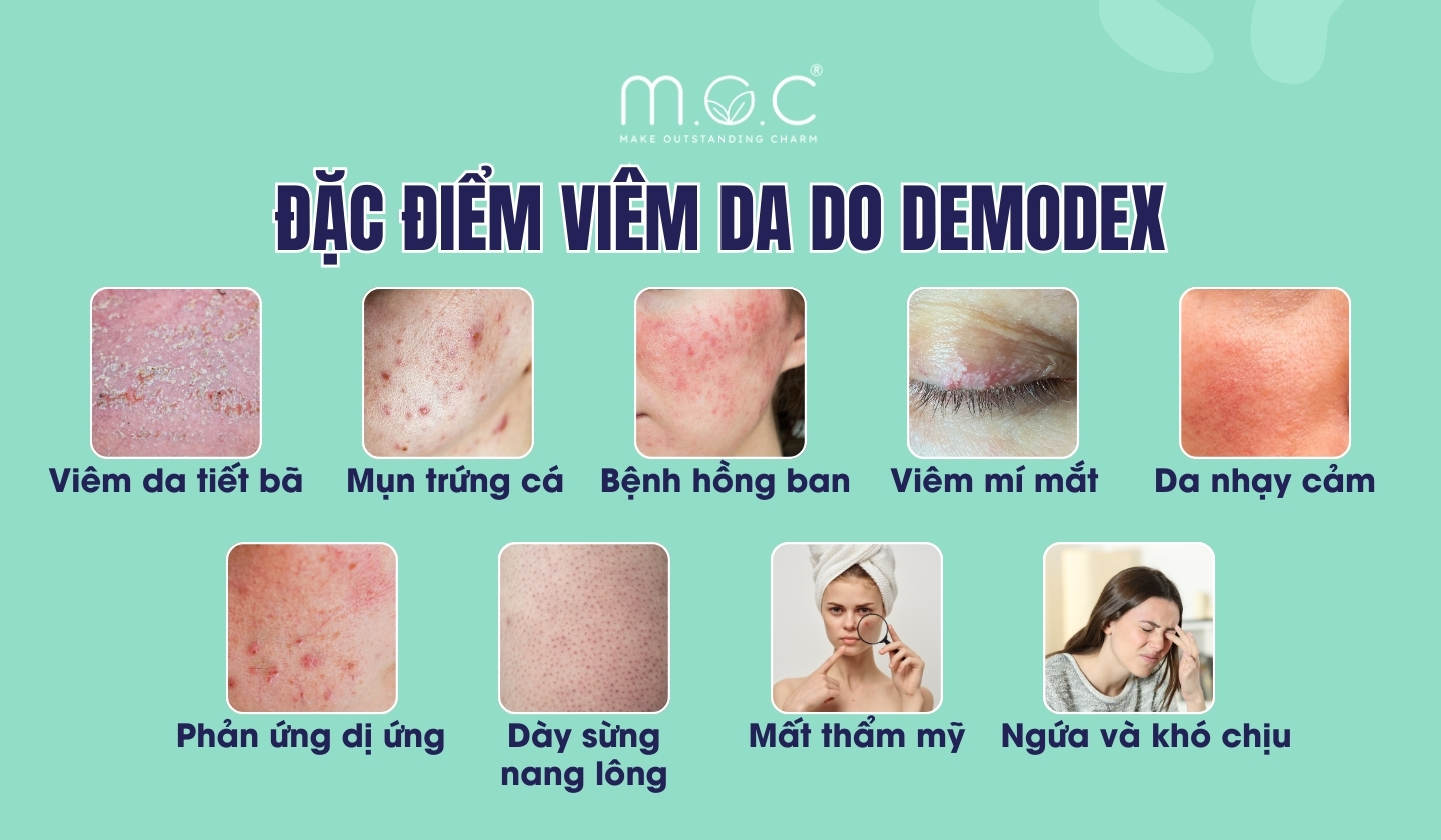 Các đặc điểm viêm da do Demodex