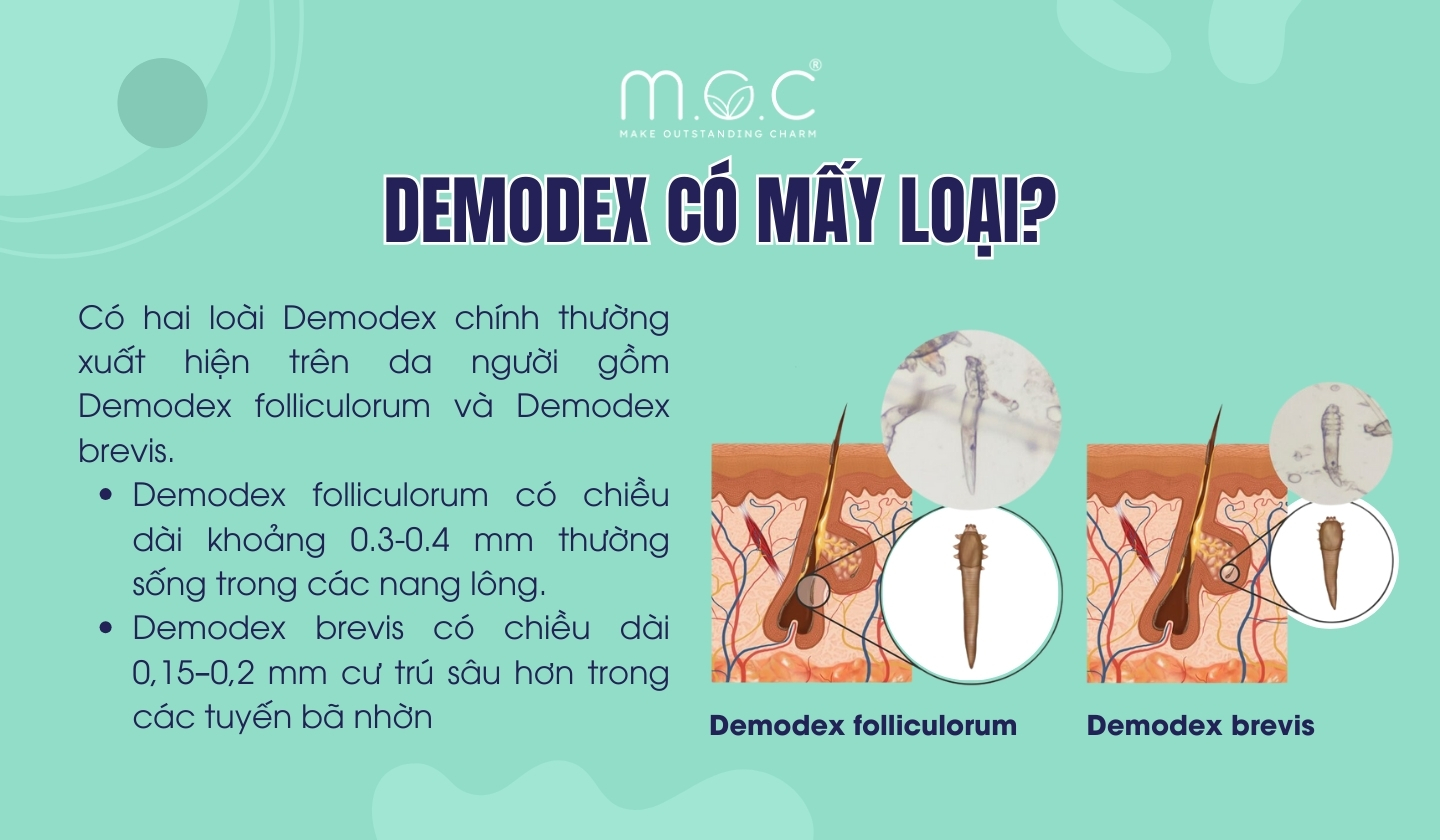 Demodex có 2 loại gồm Demodex folliculorum và Demodex brevis