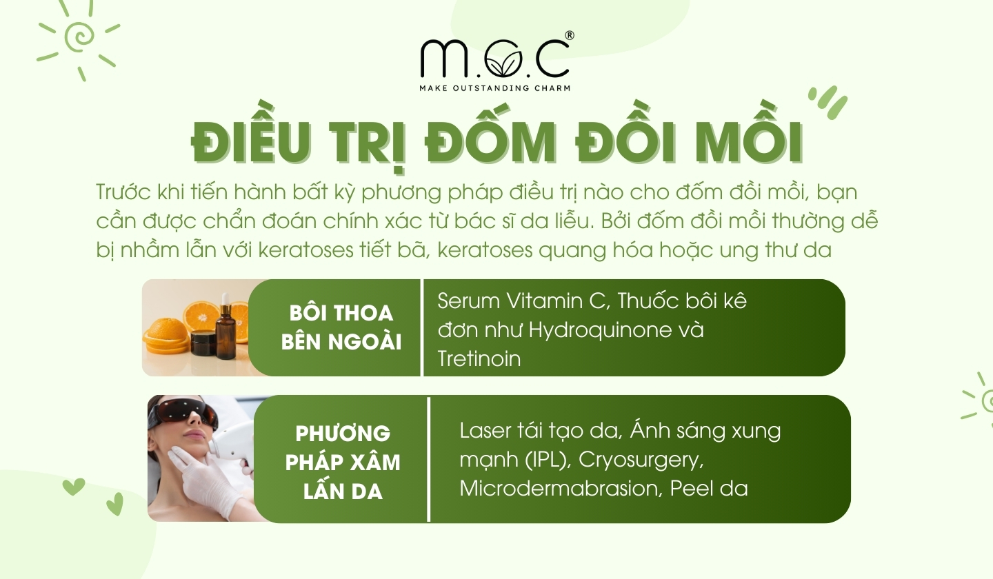 Các cách điều trị đốm đồi mồi