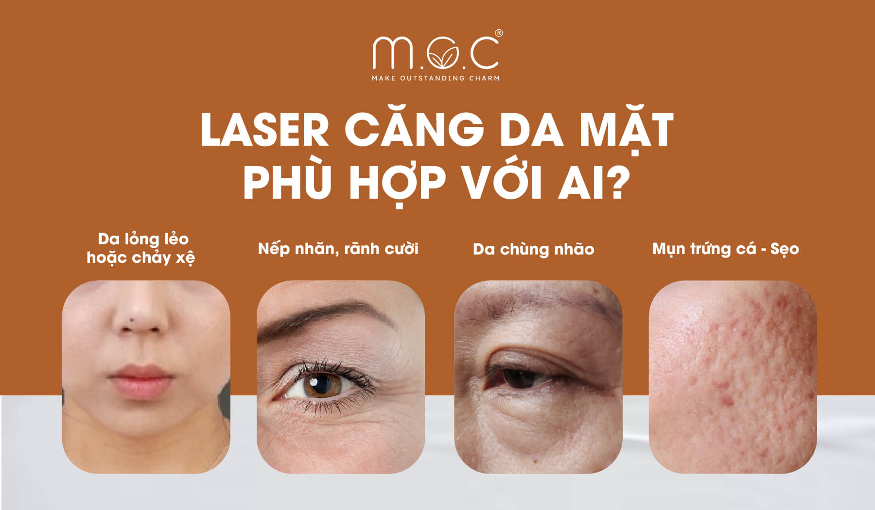 Những ai có thể căng da mặt bằng laser?