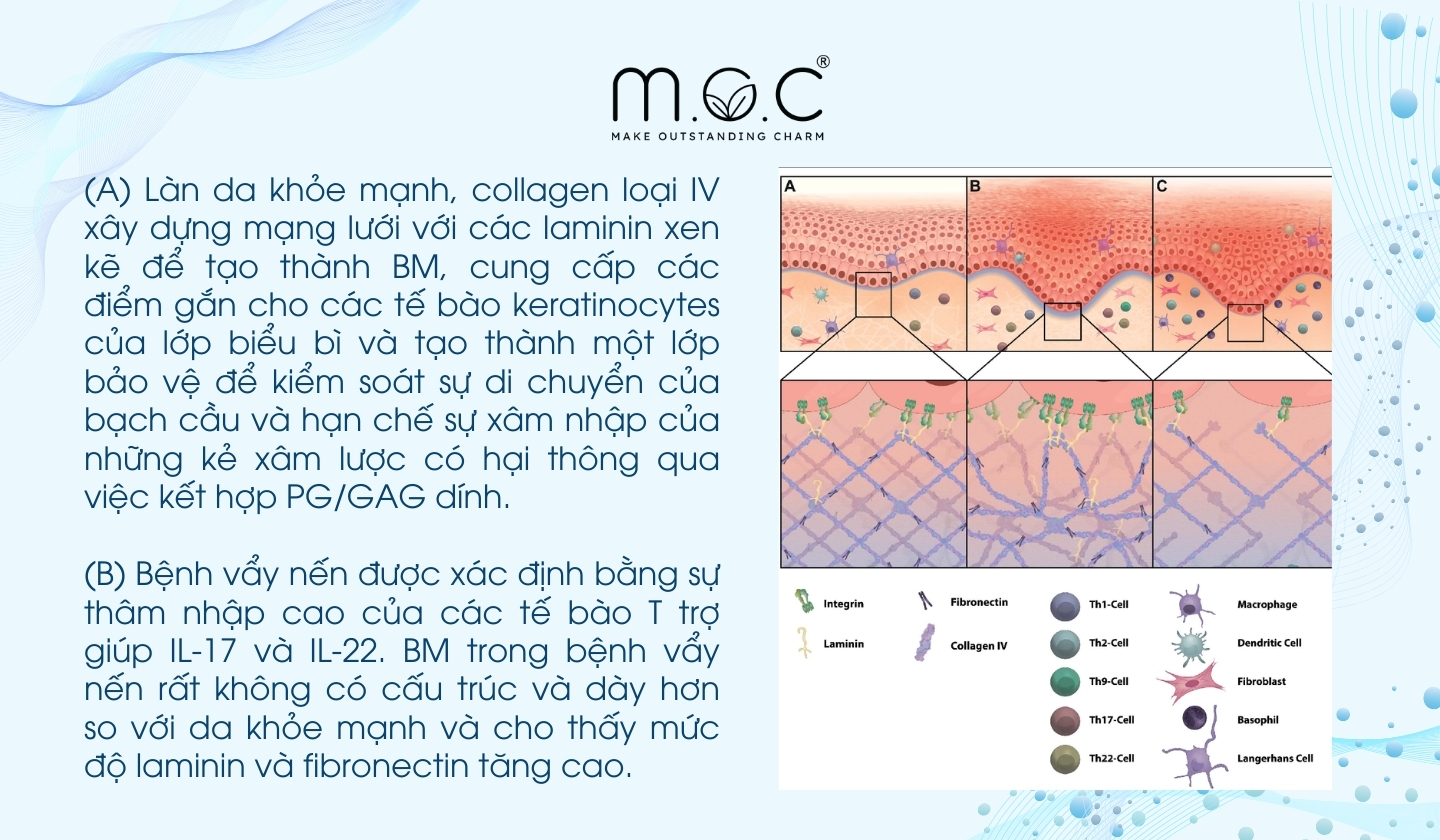 Sự khác biệt của ma trận nội bảo của da khỏe và da bị nhiễm trùng hoặc viêm