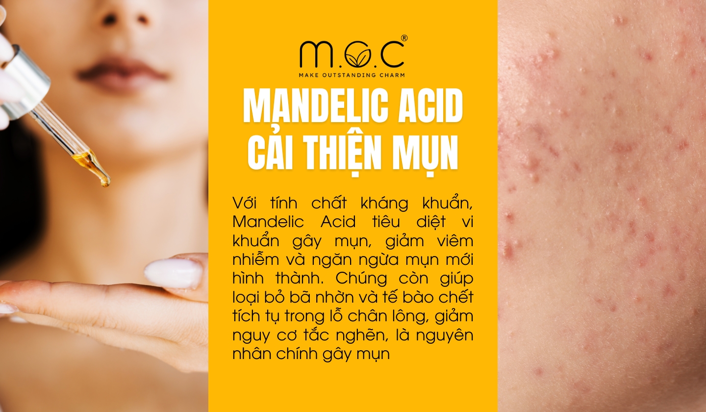 Mandelic Acid hỗ trợ quá trình cải thiện mụn trứng cá