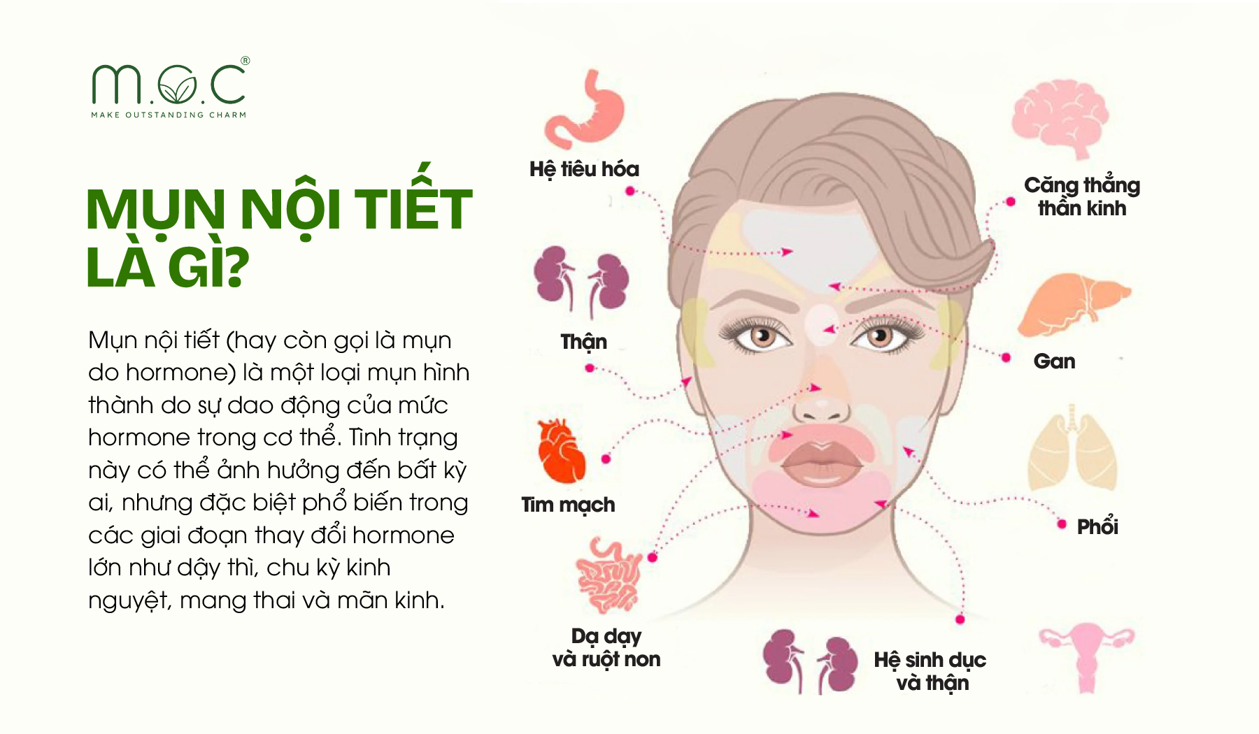 Mụn nội tiết là gì?