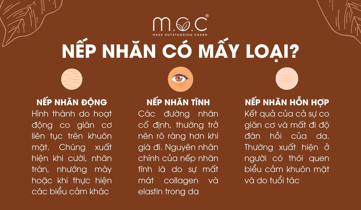 Nếp nhăn có mấy loại?