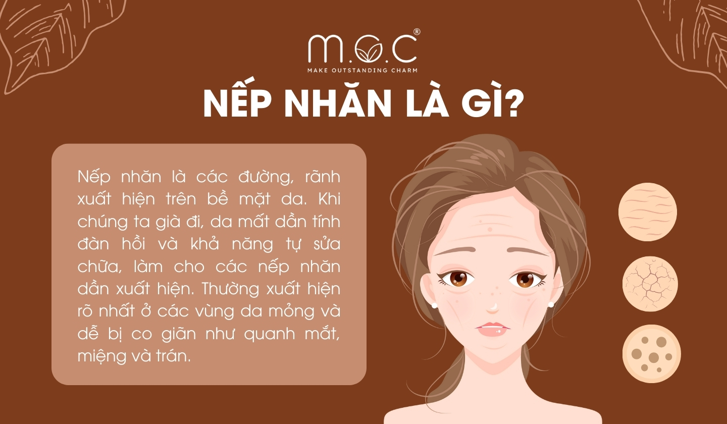 Nếp nhăn là gì?