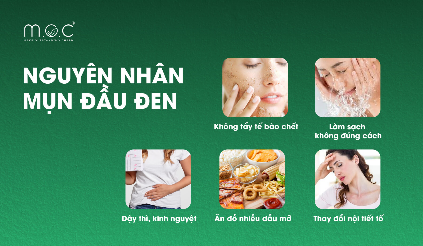 Những nguyên nhân gây mụn đầu đen