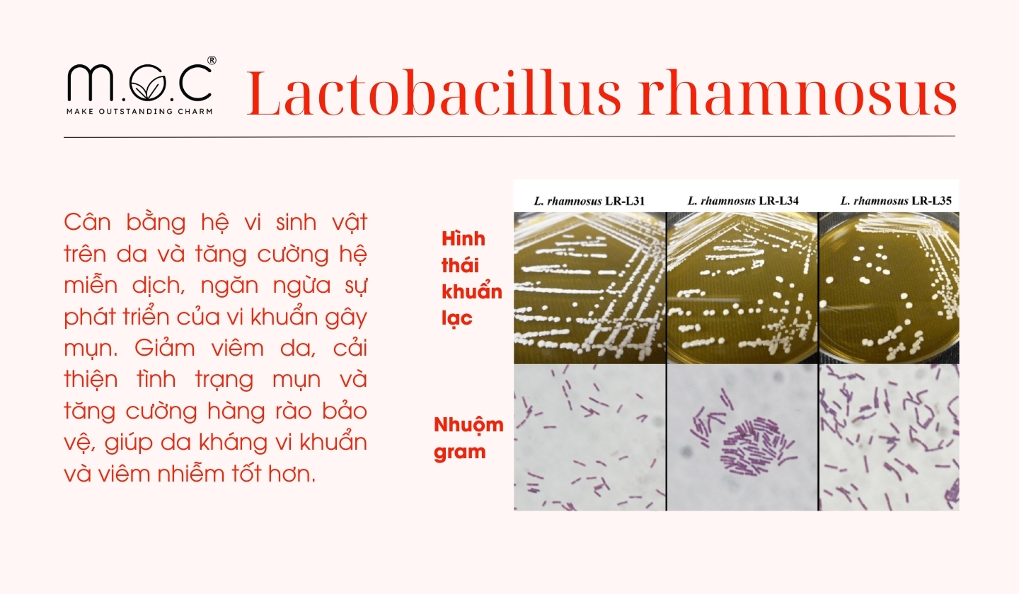 Chủng loài Probiotics Lactobacillus rhamnosus