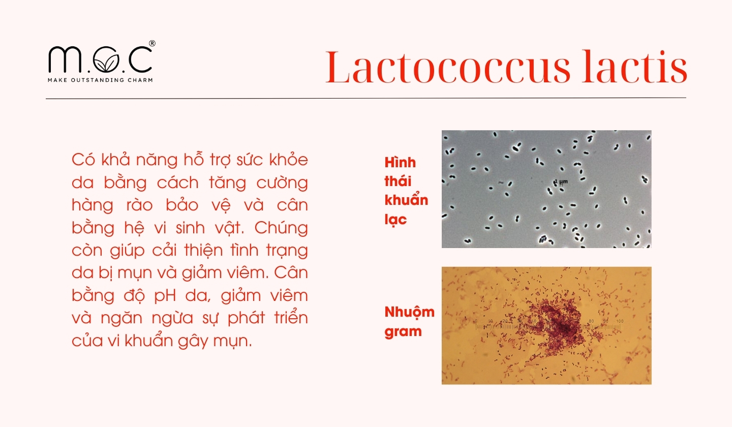 Chủng loài Probiotics Lactococcus lactis