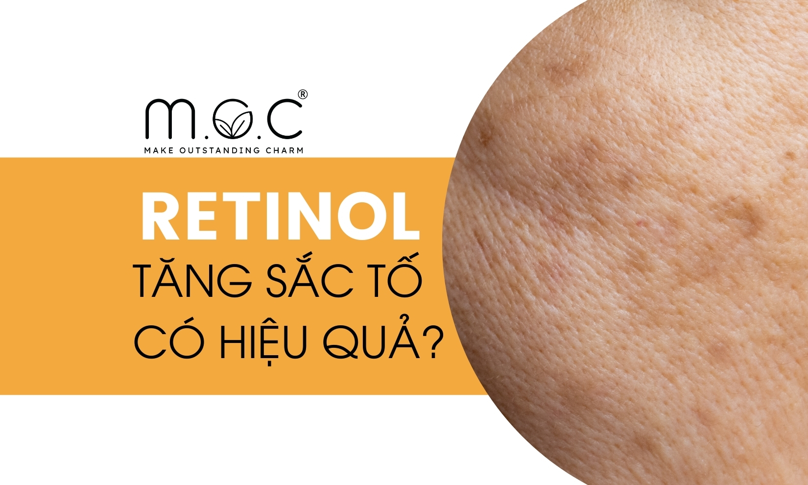 Retinol giảm tăng sắc tố da