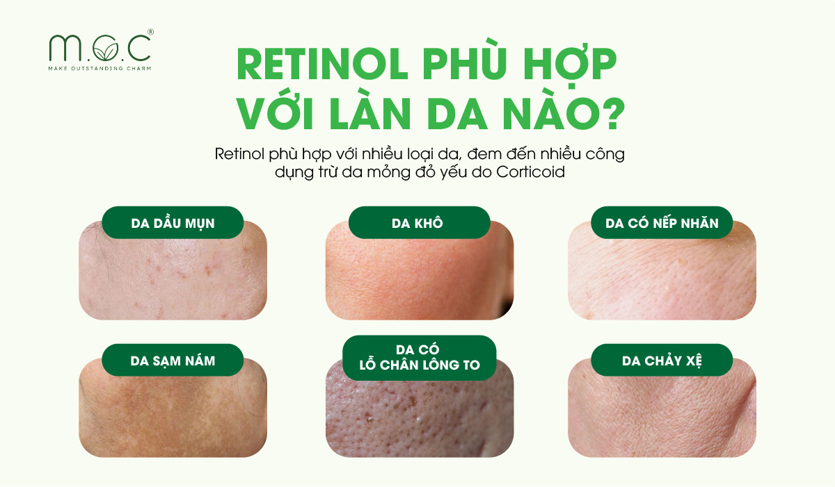 Retinol phù hợp với những làn da nào?