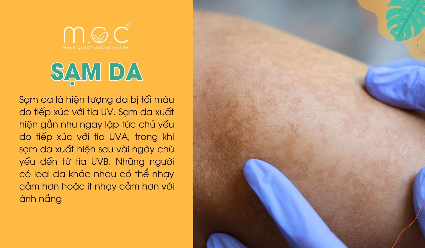 Sạm da là hiện tượng da bị tối màu do tiếp xúc với tia UV