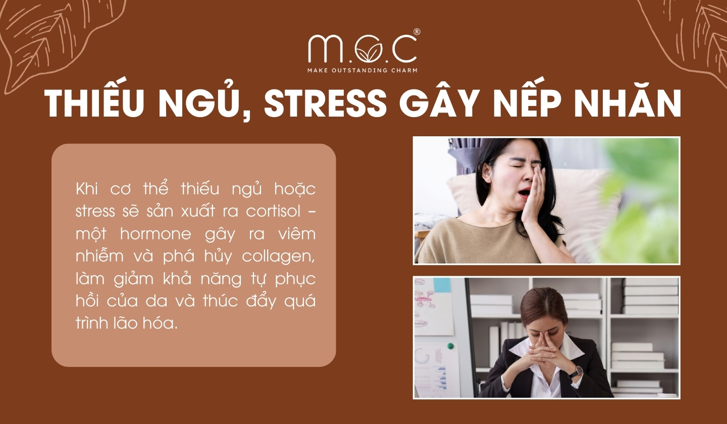 Thiếu ngủ, stress góp phần gây nếp nhăn trên da