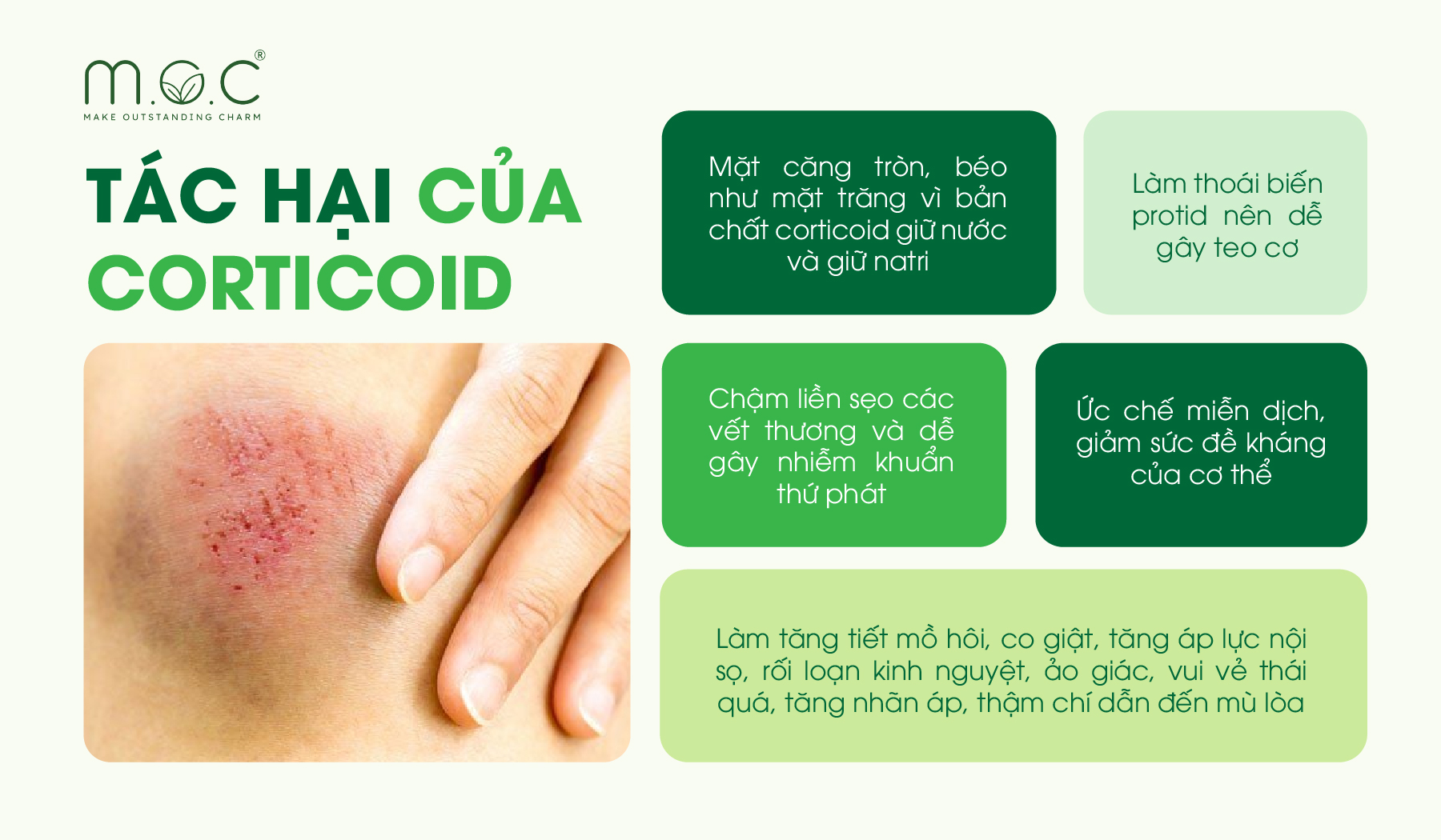 Những tác hại nguy hiểm của Corticoid khi lạm dụng