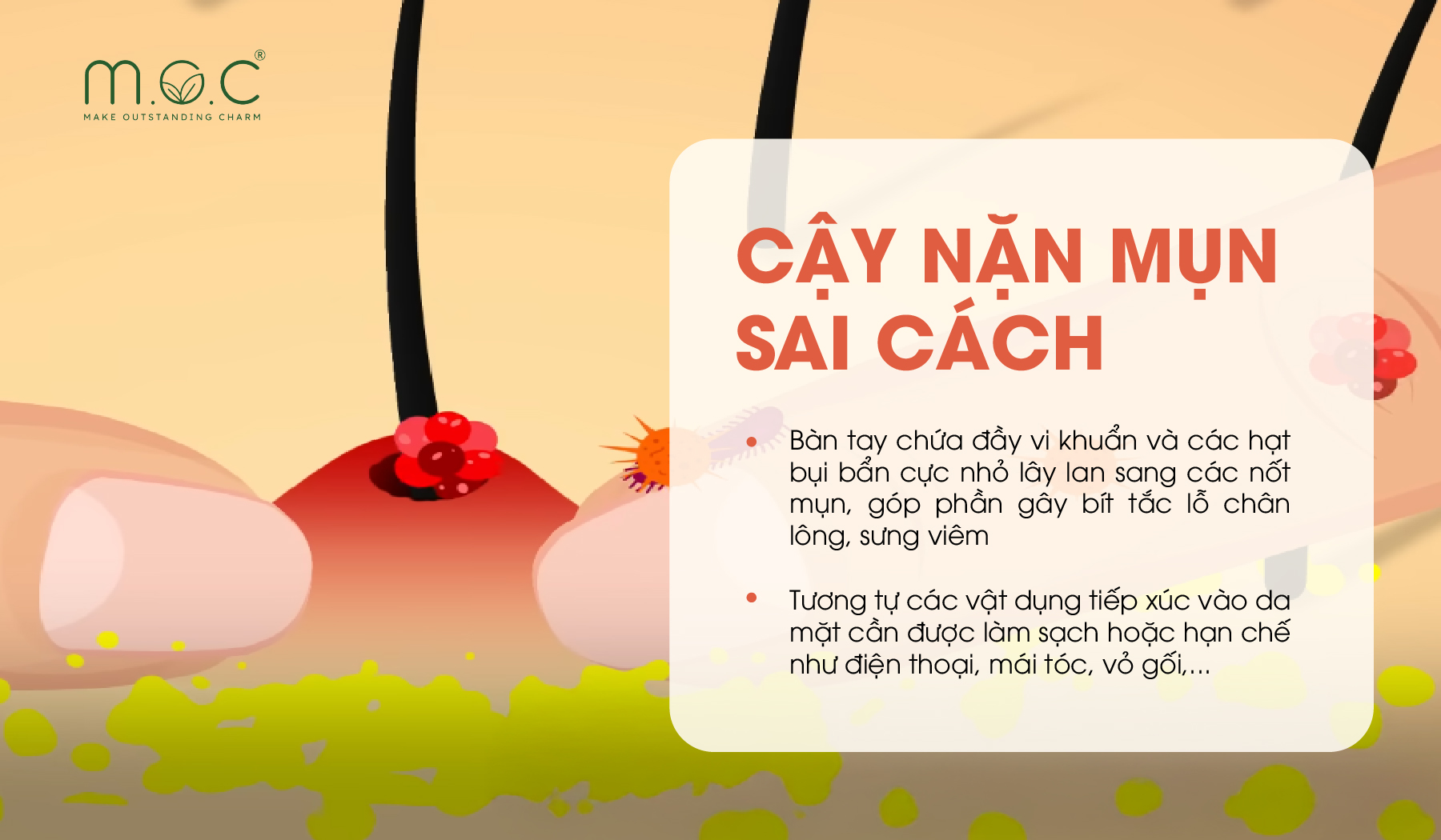 Các tác hại của cậy nặn mụn sai cách