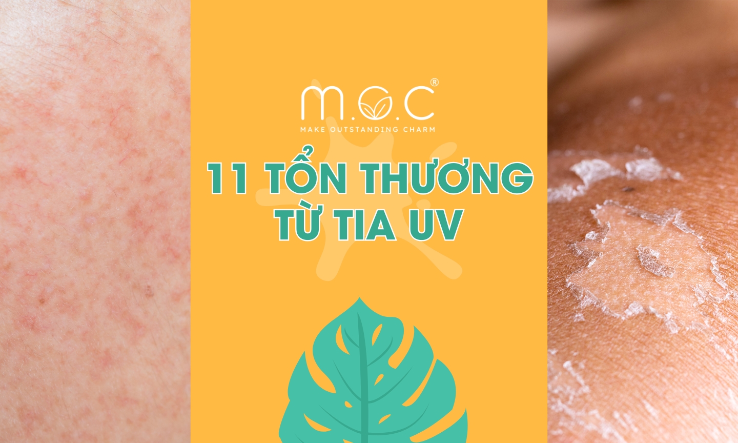 Tác hại tia UV