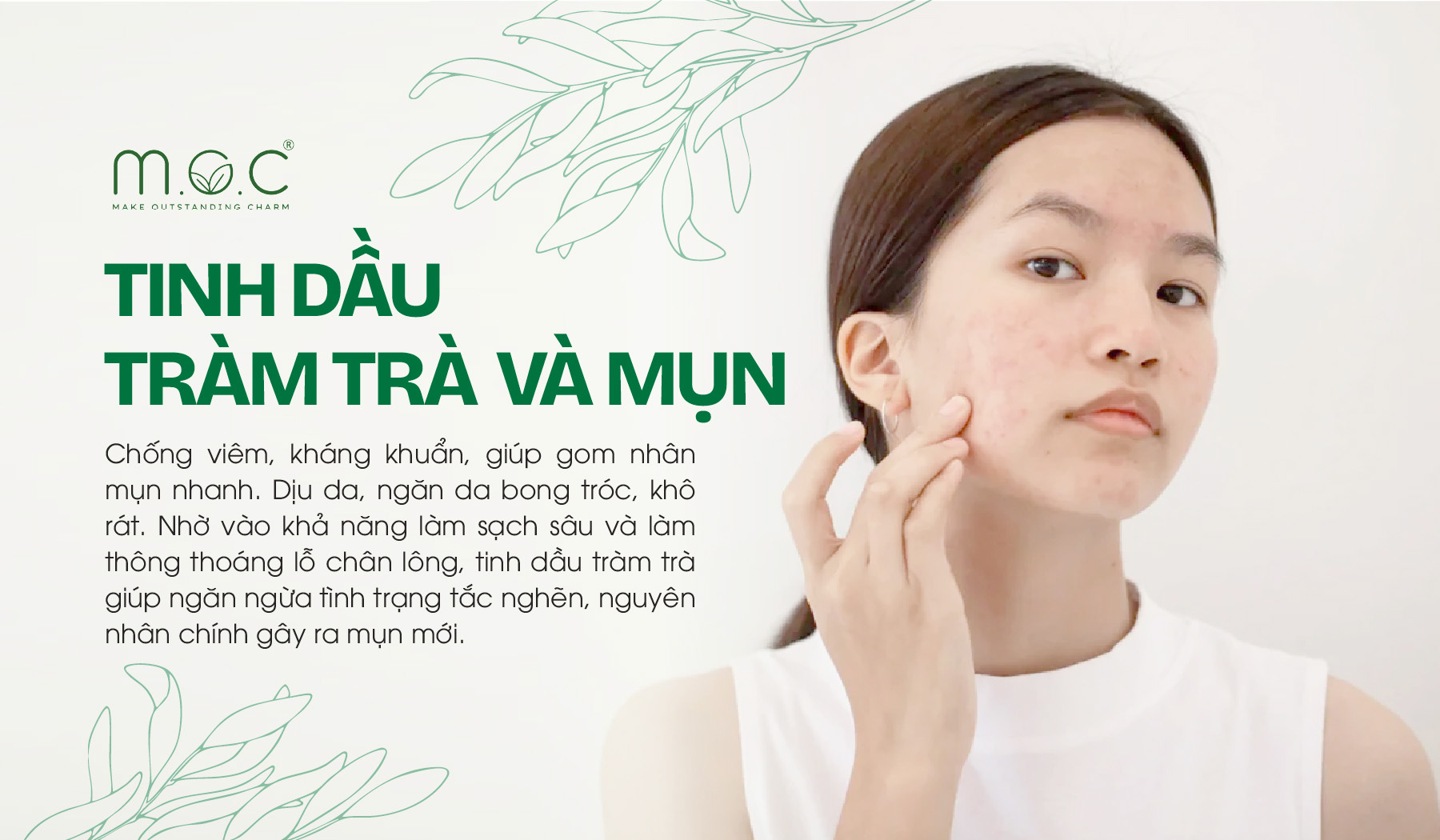 Tinh dầu tràm cải thiện mụn