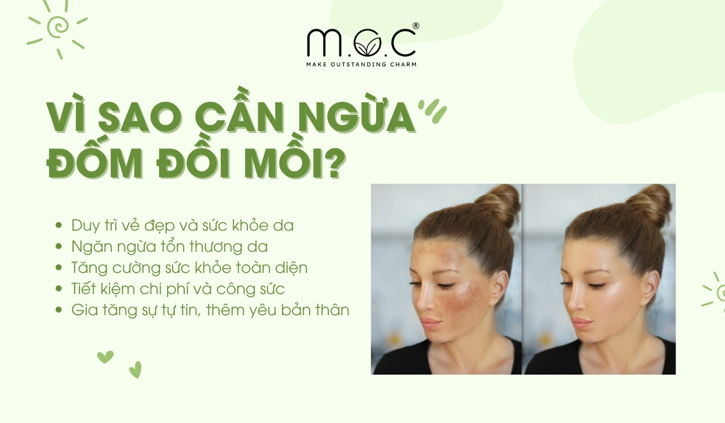 Vì sao cần ngăn chặn đốm đồi mồi cho da?