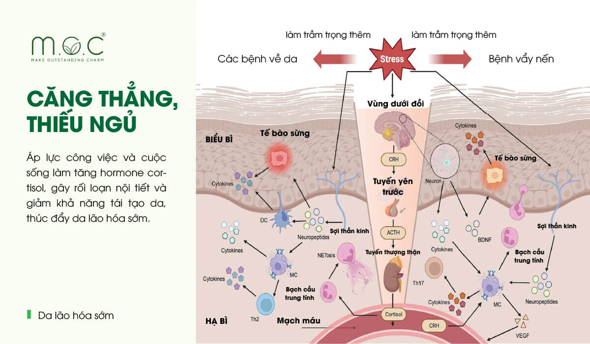 Căng thẳng, thiếu ngủ là một trong những nguyên nhân khiến da lão hóa sớm