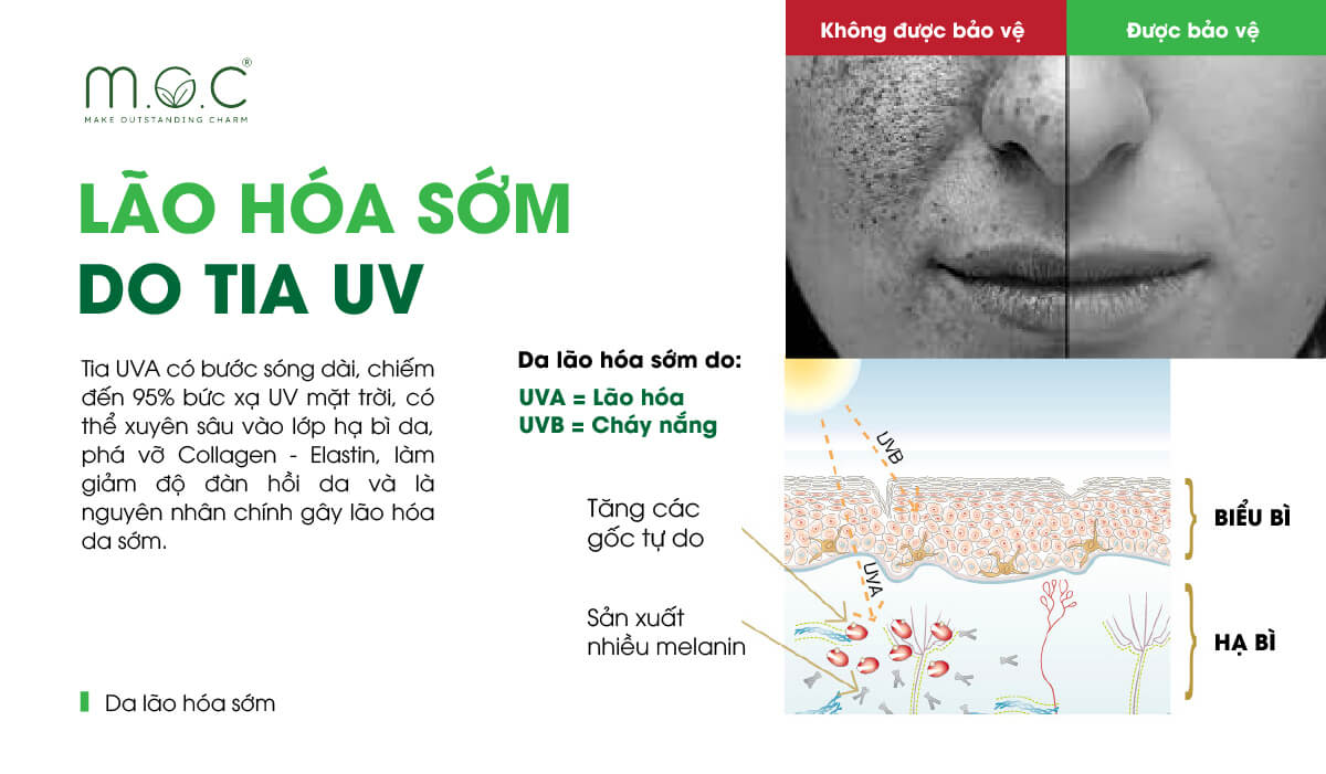 Tia UV là "thủ phạm" hàng đầu gây lão hóa da sớm