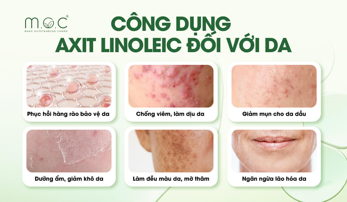 Những lợi ích Linoleic Acid cho da