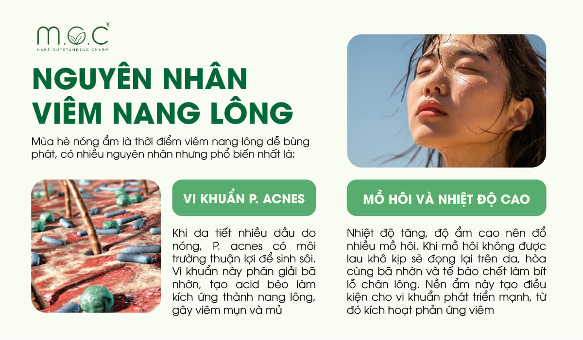 Các nguyên nhân chính gây viêm nang lông
