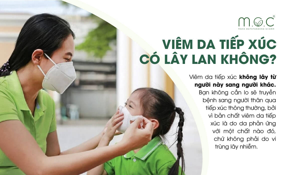 Viêm da tiếp xúc do khẩu trang có lây lan?