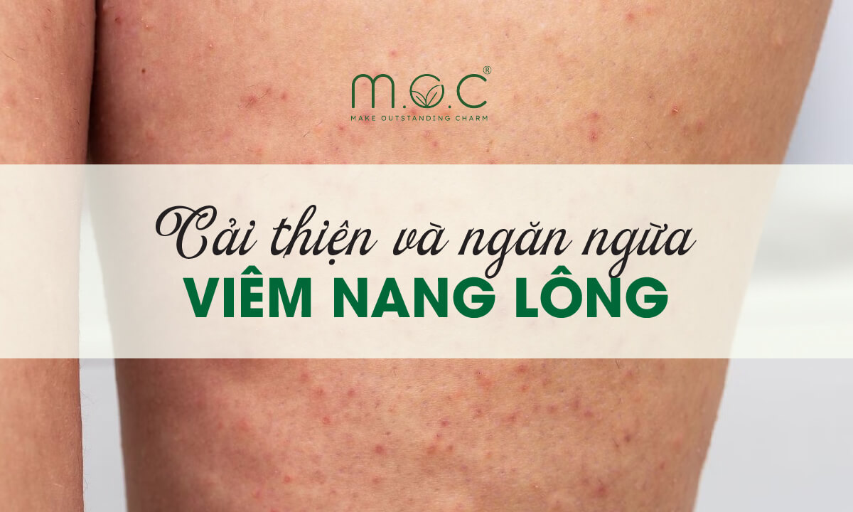 viêm nang lông