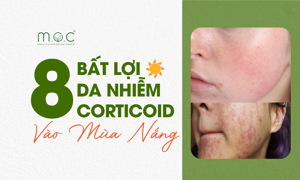 Những bất lợi của da nhiễm corticoid mùa nắng