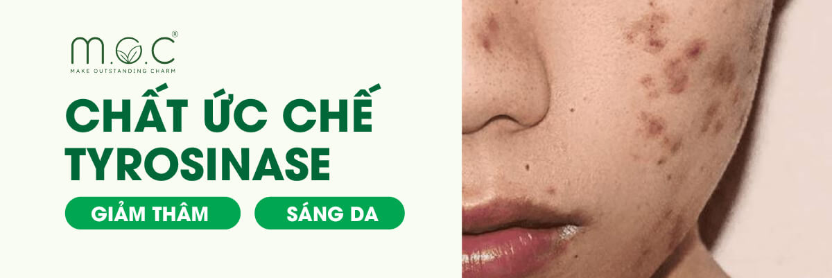 banner single