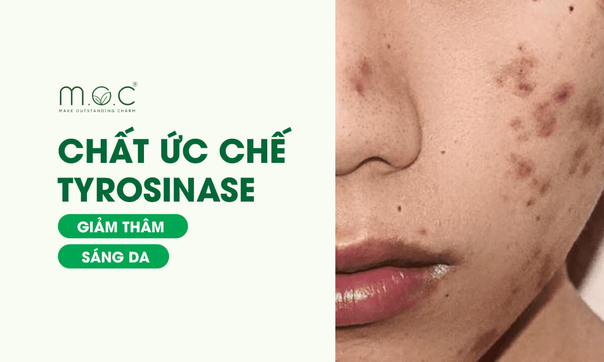 chất ức chế tyrosinase