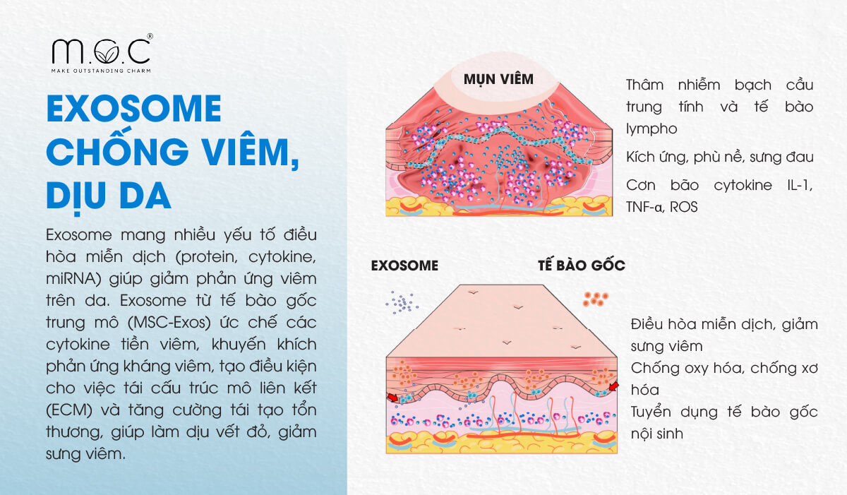 Exosome hỗ trợ chống viêm, dịu da tối đa