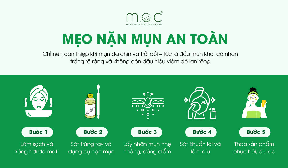 Các bước nặn mụn an toàn tại nhà