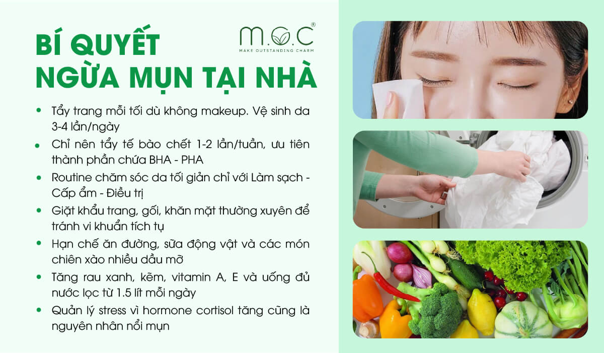 Các bí quyết ngừa mụn tại nhà