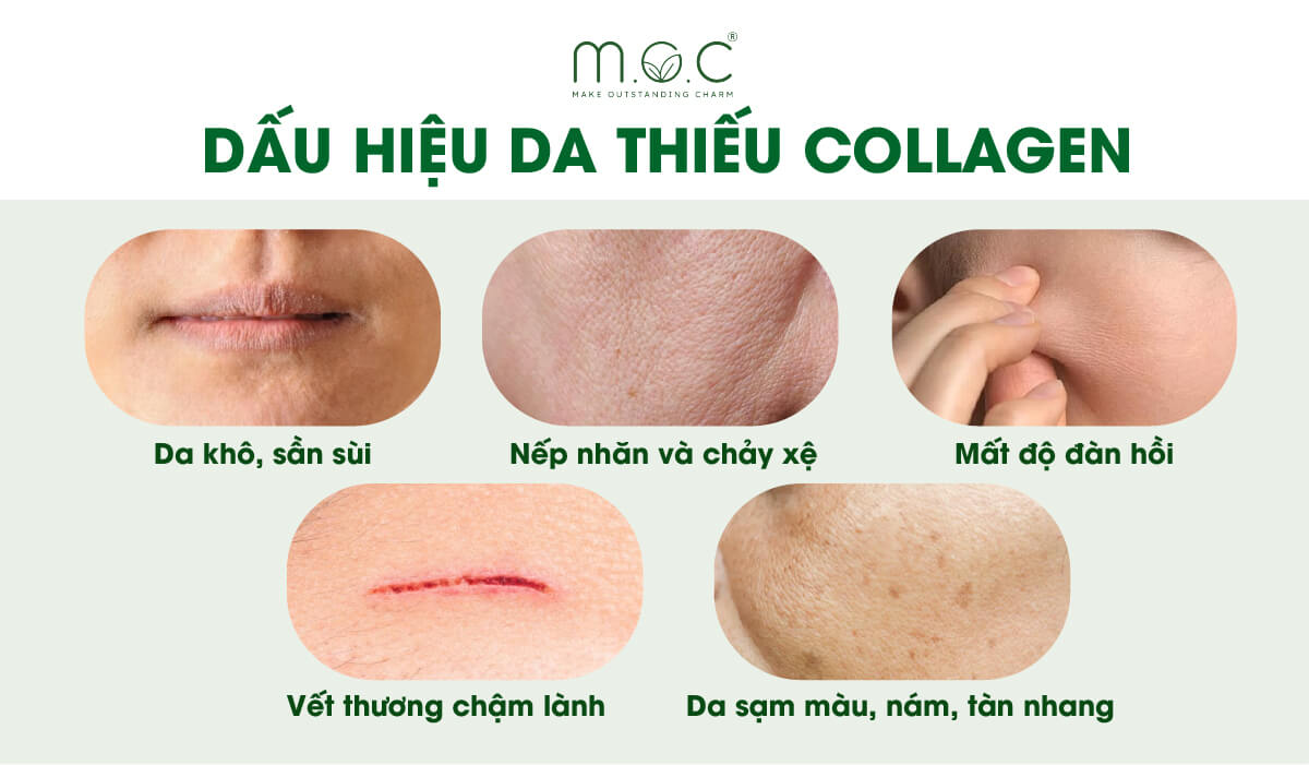 Dấu hiệu da đang thiếu Collagen