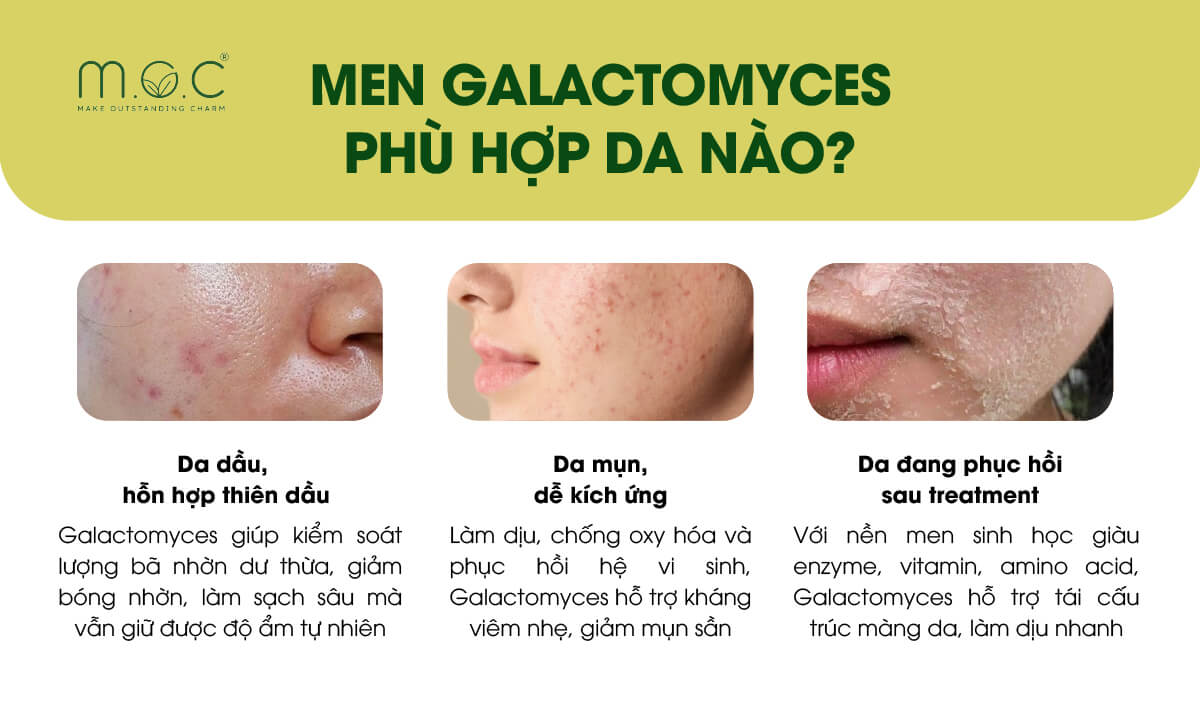 Men Galactomyces phù hợp với làn da nào?