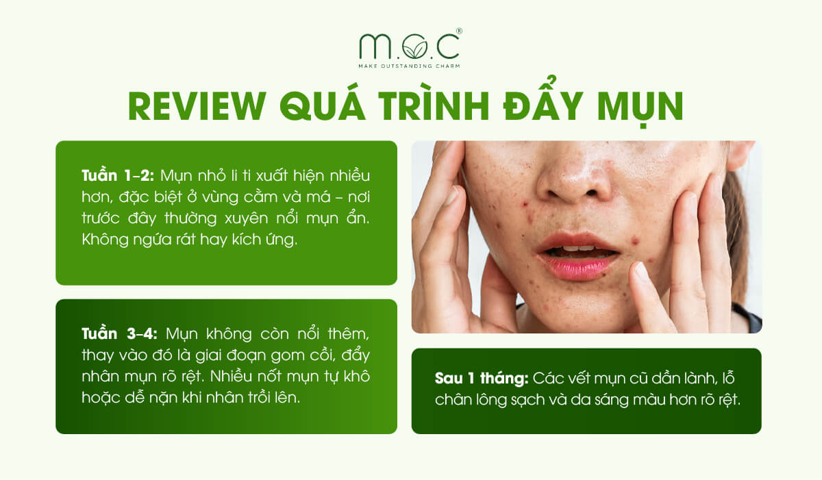 Review nhanh quá trình đẩy mụn diễn ra