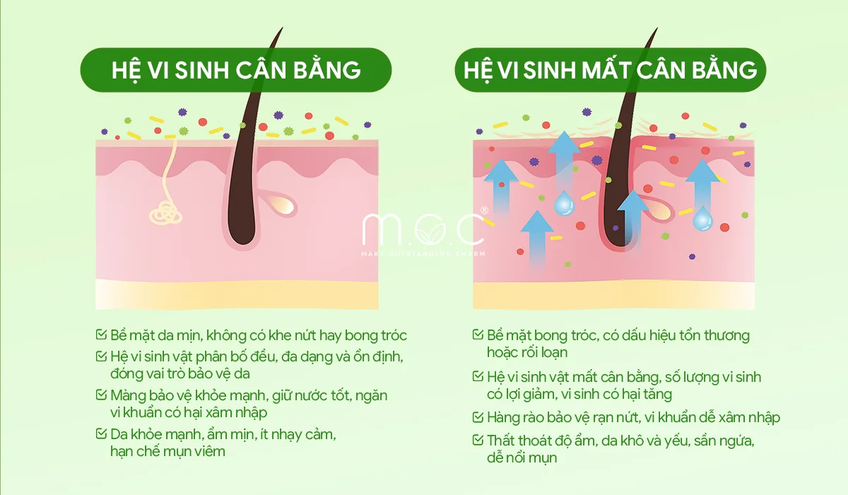 Serum-can-bang-he-vi-sinh-Prebiome-2