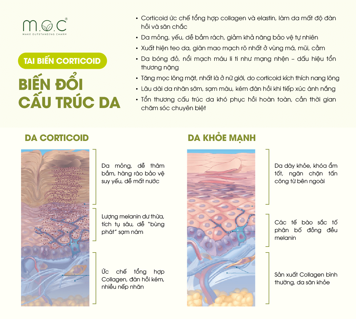 Tai biến da nhiễm Corticoid: Biến đổi cấu trúc da
