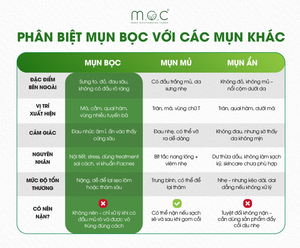 Phân biệt mụn bọc với các mụn khác
