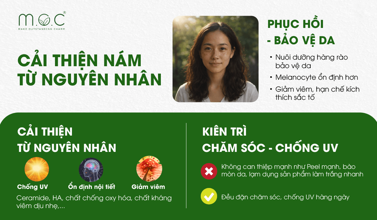 Cải thiện nám da từ nguyên nhân